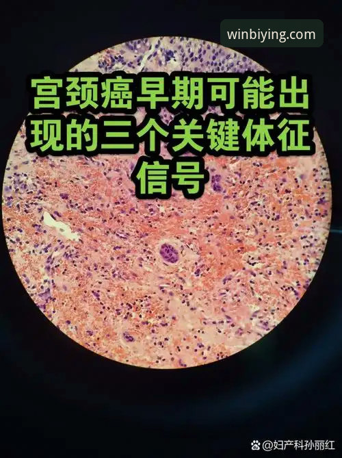必赢平台入口攻略 3个关键信号解读:奥尔西眼中的意大利足球裁判风波与帅位暗流